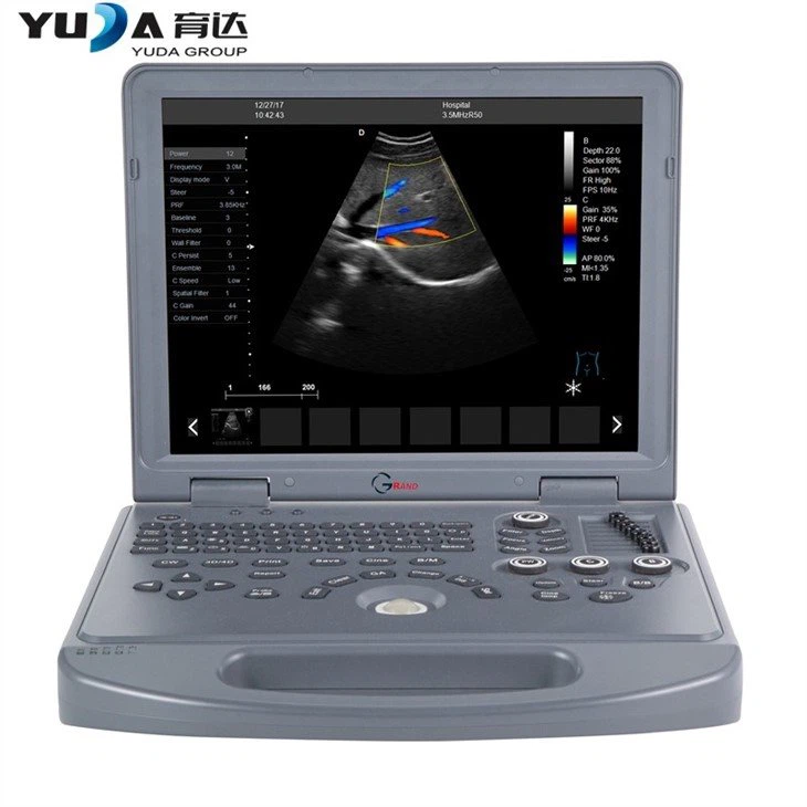 15 LED Screen High Resolution Portable 3D Ultrasound